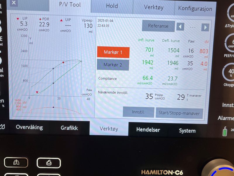 PV-tool (Hamilton) for å teste lungenes rekrutterbarhet på respiratorpasienter